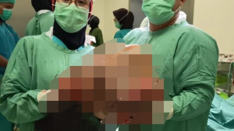 ATAS INSTRUKSI WALI KOTA, RSD IDAMAN CEPAT TANGANI TUMOR WARGA LIANG ANGGANG
